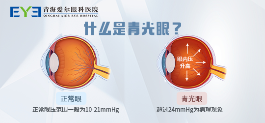 婴幼儿、青少年都有患上青光眼的可能_青海爱尔眼科医院